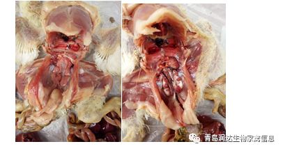 肾传支治疗案例